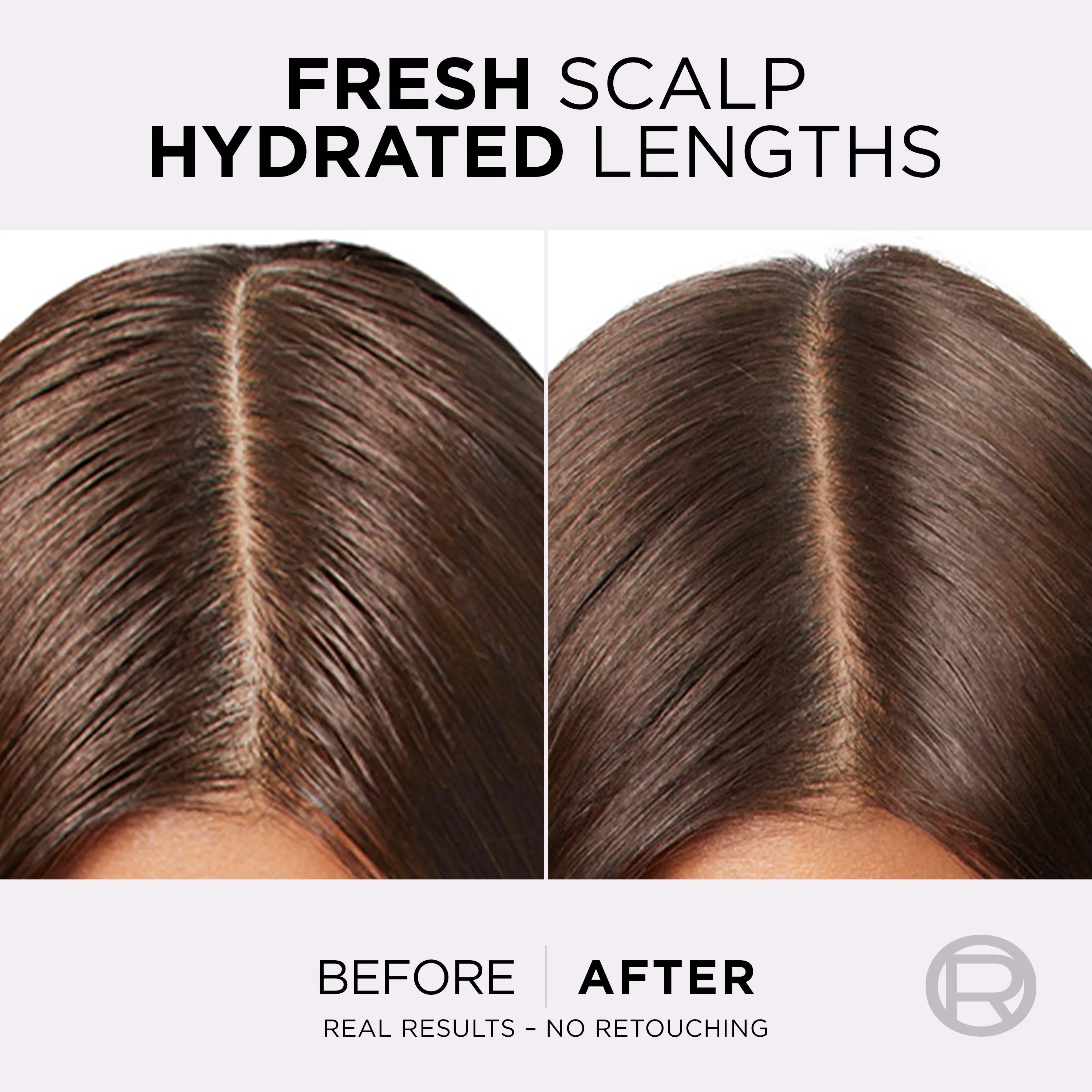 L’Oreal Paris Elvive Hyaluron Pure 72h Rehydrating Conditioner for Oily Scalp & Dehydrated Lengths 200Ml