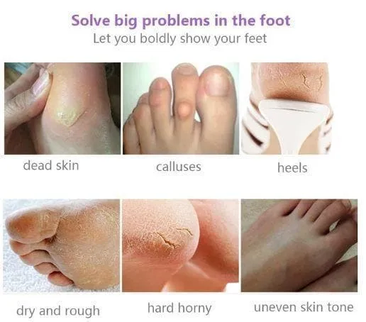 Silky Feet™ - Exfoliating Foot Masks (Buy 1, Get 2 FREE)